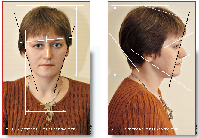 "Ryazan subtype"