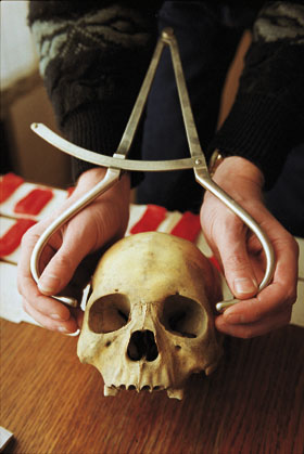 Skull of a proto-Erzya, Ryazan Oblast